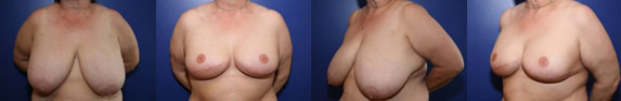Patient Gallery Case Example Before & After